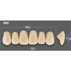 MFT 2L15 O49 Anterior x6