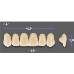 MFT 2M1 R47 Anterior x6