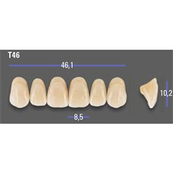 MFT 2M1 T46 Anterior x6