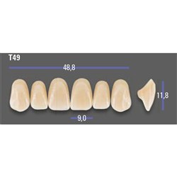 MFT 2M1 T49 Anterior x6