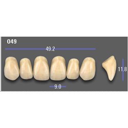 VITA MFT Upper Anterior Classical Shade A1 Mould O49