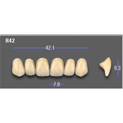 VITA MFT Upper Anterior Classical Shade A1 Mould R42