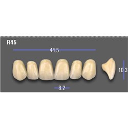 VITA MFT Upper Anterior Classical Shade A1 Mould R45
