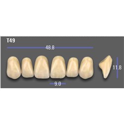 VITA MFT Upper Anterior Classical Shade A1 Mould T49
