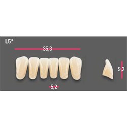 Vitapan Anterior Shade A1 Lower Mould L5 Set 6