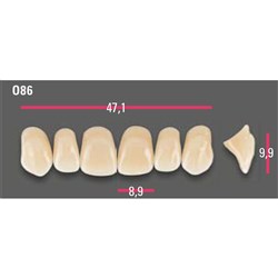 Vitapan Anterior Shade A1 Upper Mould O86 Set 6