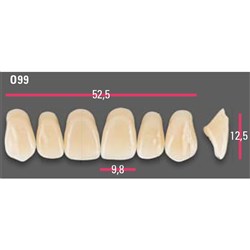 Vitapan Anterior Shade A1 Upper Mould O99 Set 6