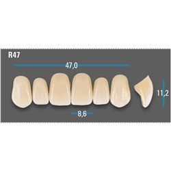 Vitapan Plus Anterior Shade A1 Upper Mould R47 Set 6