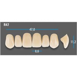 Vitapan Plus Anterior Shade A1 Upper Mould R47 Set 6