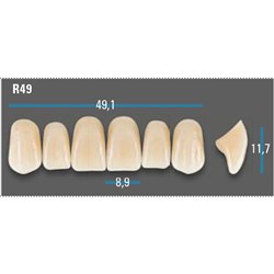 Vitapan Plus Anterior Shade A1 Upper Mould R49 Set 6