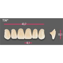 Vitapan Anterior Shade A1 Upper Mould T36 Set 6