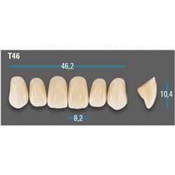 Vitapan Plus Anterior Shade A1 Upper Mould T46 Set 6