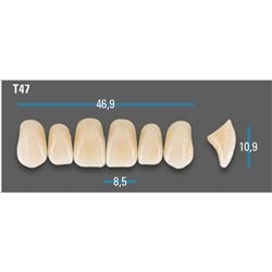 Vitapan Plus Anterior Shade A1 Upper Mould T47 Set 6