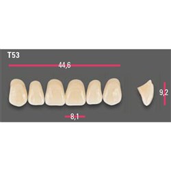 Vitapan Anterior Shade A1 Upper Mould T53 Set 6