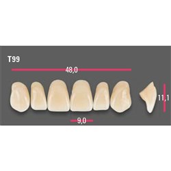 Vitapan Anterior Shade A2 Upper Mould T99 Set 6