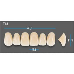 Vitapan Plus Anterior Shade A3.5 Upper Mould T48 Set 6