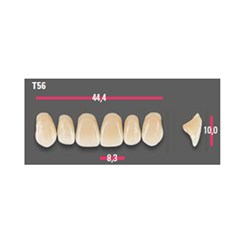 Vitapan Anterior Shade C4 Upper Mould T56 Set 6