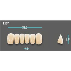 Physiodens Anterior Shade A1 Lower Mould L1S Set 6