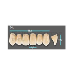 Physiodens Anterior Shade A1 Upper Mould O4L Set 6