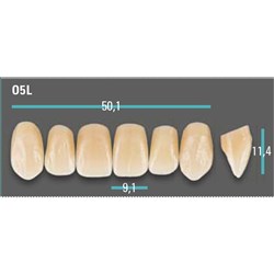 Physiodens Anterior Shade A1 Upper Mould O5L Set 6