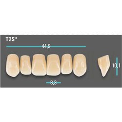 Physiodens Anterior Shade A1 Upper Mould T2S Set 6