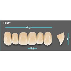 Physiodens Anterior Shade A1 Upper Mould T4M Set 6