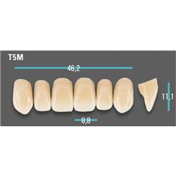 Physiodens Anterior Shade A1 Upper Mould T5M Set 6