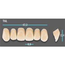 Physiodens Anterior Shade A1 Upper Mould T6L Set 6