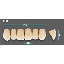 Physiodens Anterior Shade A1 Upper Mould T7M Set 6