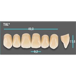 Physiodens Anterior Shade A1 Upper Mould T8L Set 6