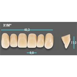 Physiodens Anterior Shade A1 Upper Mould X1M Set 6