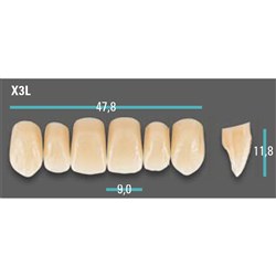 Physiodens Anterior Shade A1 Upper Mould X3L Set 6