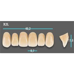 Physiodens Anterior Shade A2 Upper Mould X2L Set 6