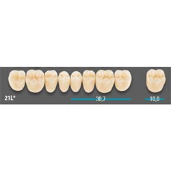 VITA Lingoform Lower Posterior Shade 0M3 Mould 21LL 3D-MASTER