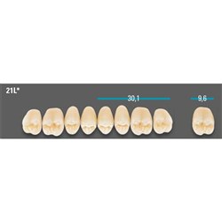 VITA Lingoform Upper Posterior Shade 0M3 Mould 21LU 3D-MASTER