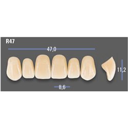 VITAPAN EXCELL Classical Upper Anterior Shade A1 Mould R47