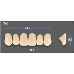 VITAPAN EXCELL Classical Upper Anterior Shade A1 Mould T44