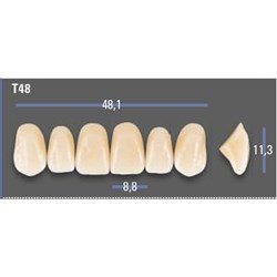 VITAPAN EXCELL Classical Upper Anterior Shade A1 Mould T48
