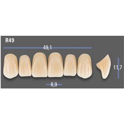 VITAPAN EXCELL Classical Upper Anterior Shade A2 Mould R49