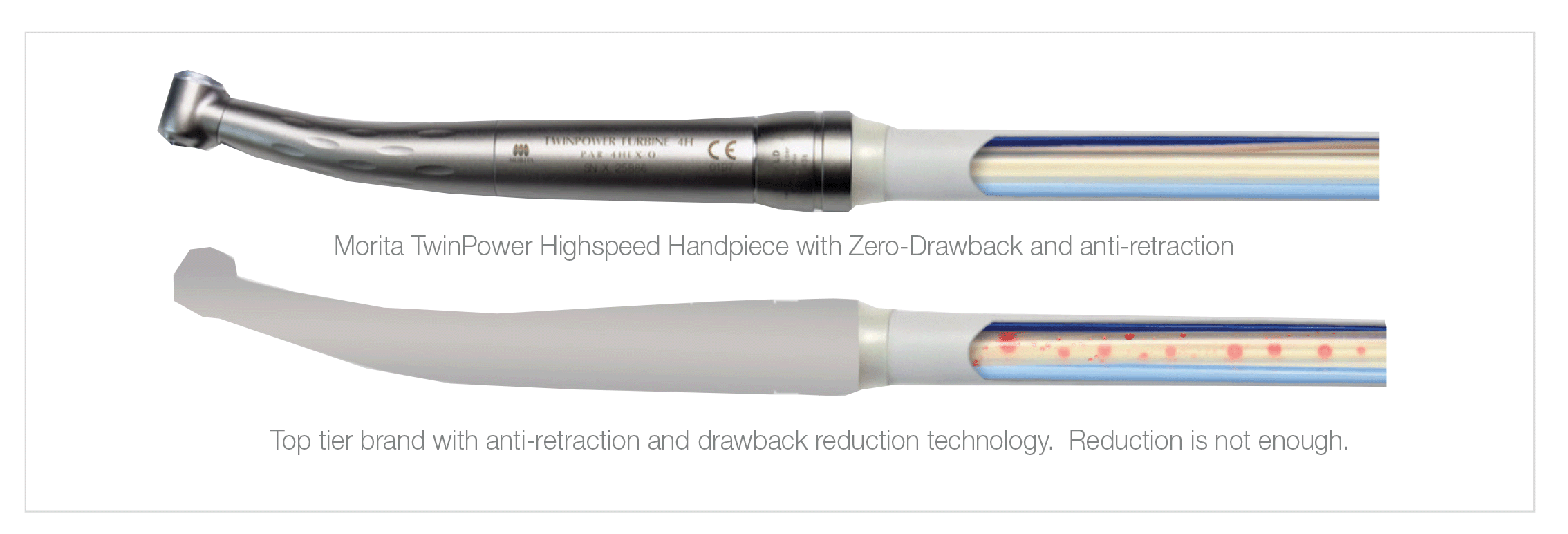 Aerosol Drawback In Handpieces - Henry Schein New Zealand