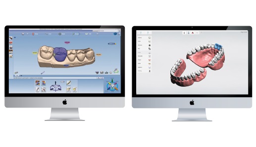 Software - CAD-CAM - Equipment - Henry Schein New Zealand