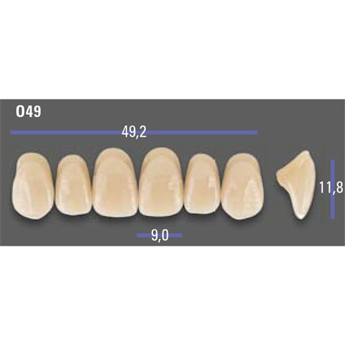 MFT 1M1 O49 Anterior x6