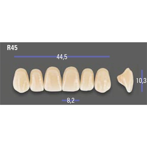 MFT 1M1 R45 Anterior x6