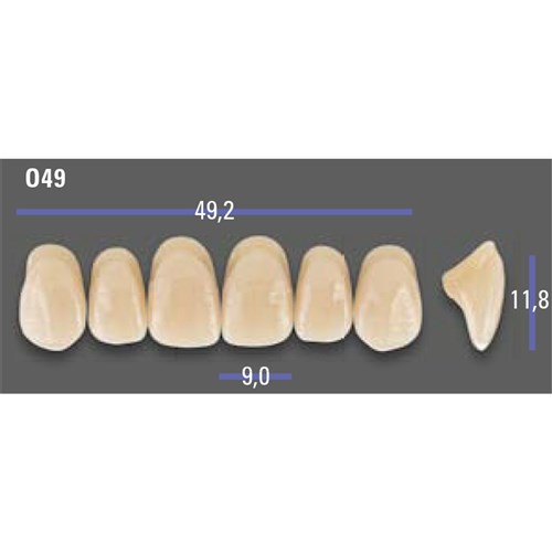 MFT 2M1 O49 Anterior x6