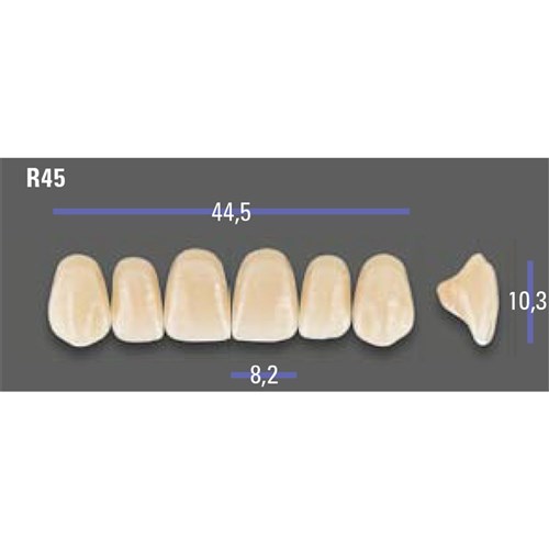 MFT 2M1 R45 Anterior x6