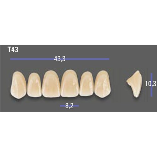 MFT 2M1 T43 Anterior x6