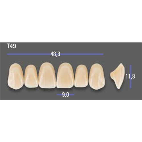 MFT 2M1 T49 Anterior x6