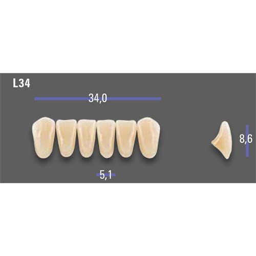 MFT 3L25 L34 Anterior x6