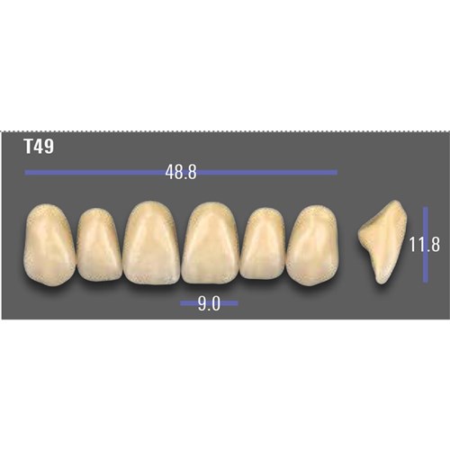 VITA MFT Upper Anterior Classical Shade A1 Mould T49