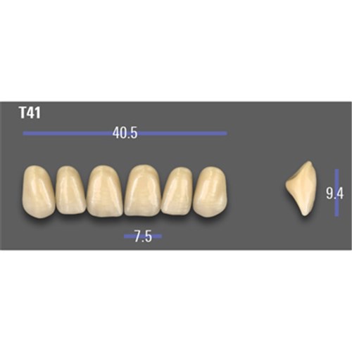 VITA MFT Upper Anterior Classical Shade A2 Mould T41
